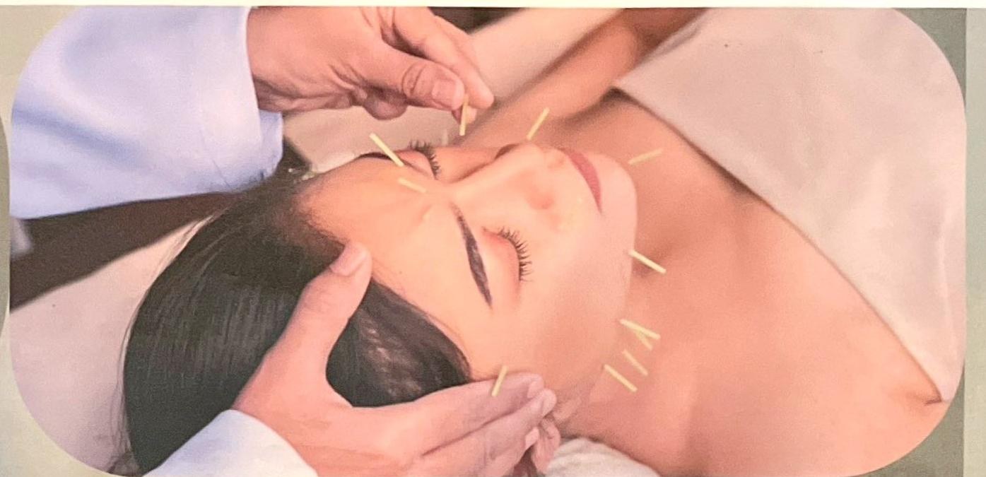 Acupuncture treatment at Family Tree Oki