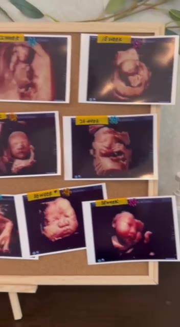 4D ultrasound growth journey, week by week