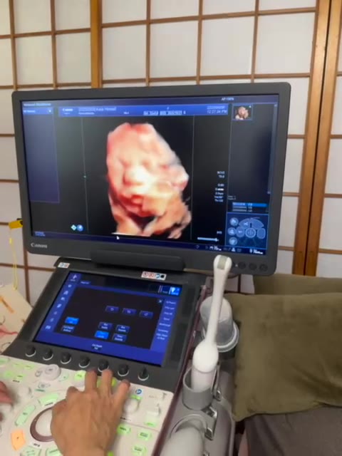 4D ultrasound session at Family Tree Oki