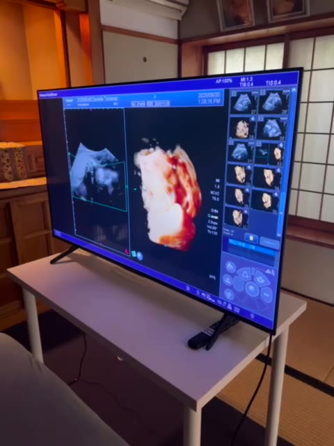 4D ultrasound imaging detail